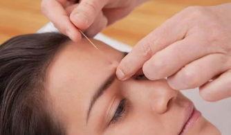 成人脏腑针灸视频讲解,揭秘传统中医养生之道